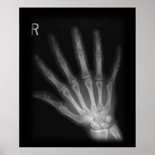 Póster Rayo X extra digital a mano derecha