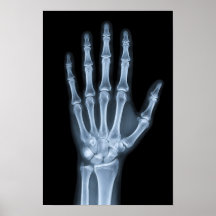 Rayos X Clínicos de Mano