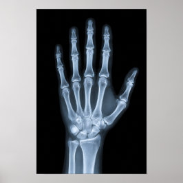 Póster Rayos X Clínicos de Mano
