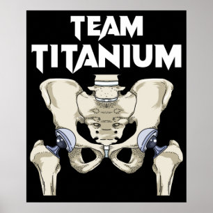 Póster Recambio de Hip Surging Recovery Gifts Hippie Hip 