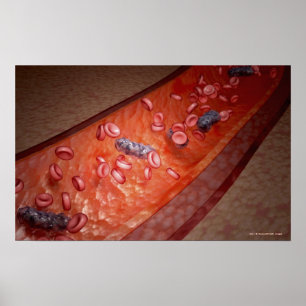 Póster Renderización microscópica de una infección sanguí