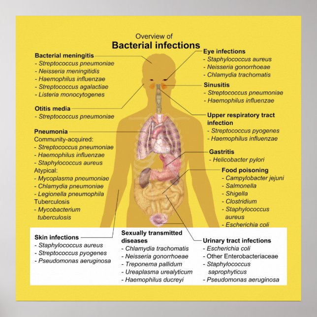 Póster Resumen de infecciones bacterianas (Frente)