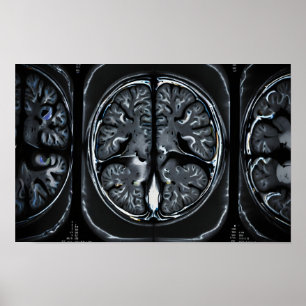 Póster Revisión cerebral por resonancia magnética