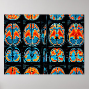 Póster Revisión cerebral por resonancia magnética