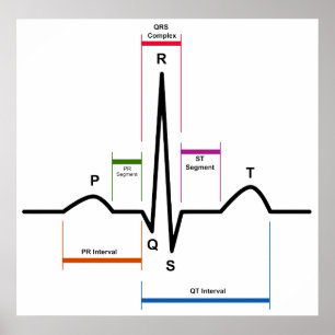 Póster Ritmo sinusal en un ECG electrocardiograma