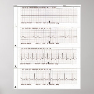 Póster ritmos ekg