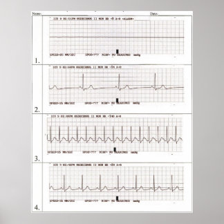 Póster ritmos ekg