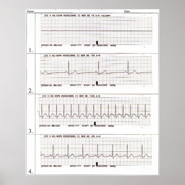 Póster ritmos ekg (Frente)