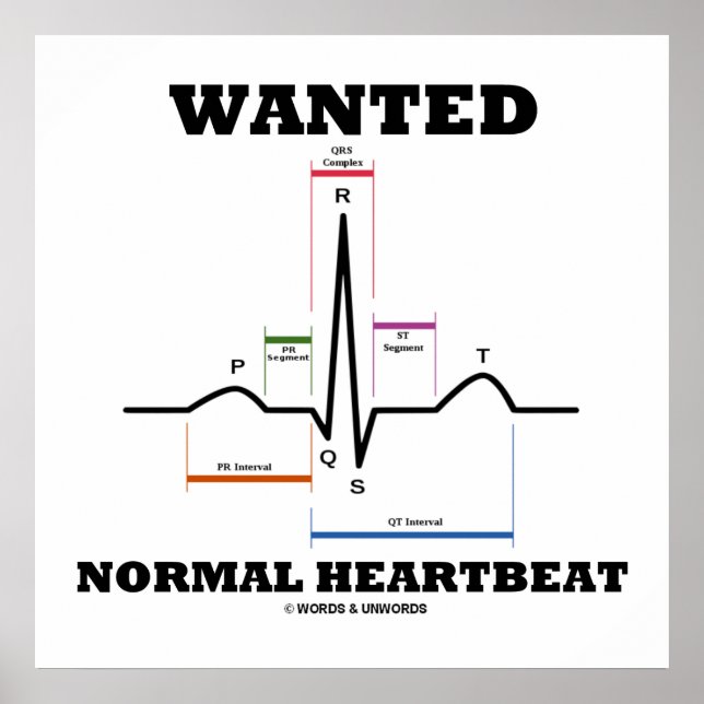 Póster Se busca electrocardiograma ECG normal (Frente)