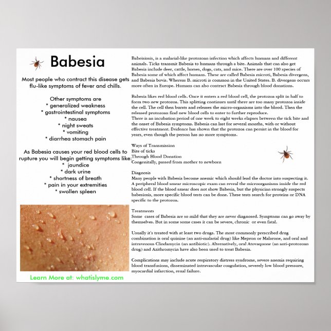Póster Síntomas de Babesia y Poster de transmisión (Frente)