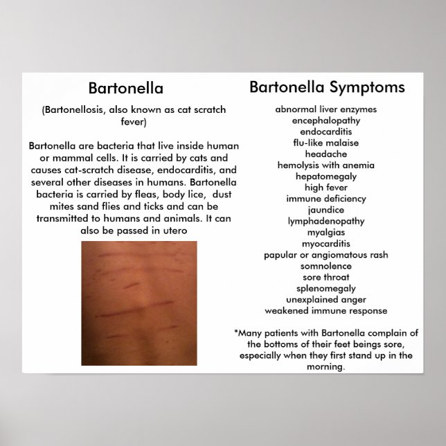 Póster Síntomas de Bartonella Poster educativo (Frente)