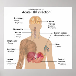 Póster Síntomas principales de la infección VIH aguda