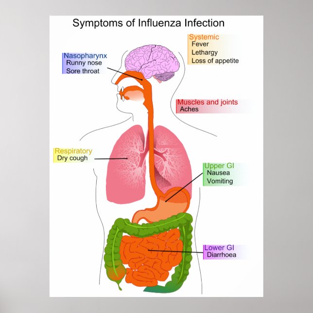 Póster Síntomas principales de un diagrama de infección p (Frente)