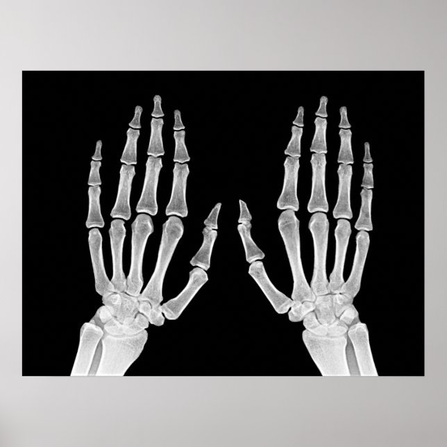 Póster Skeleton Hands Xray Picture Anatomía Humana foto (Frente)