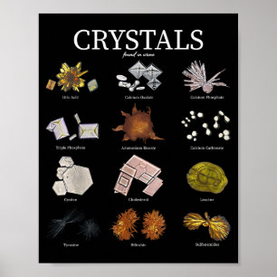 Póster Técnico de laboratorio de cristal de orina de labo