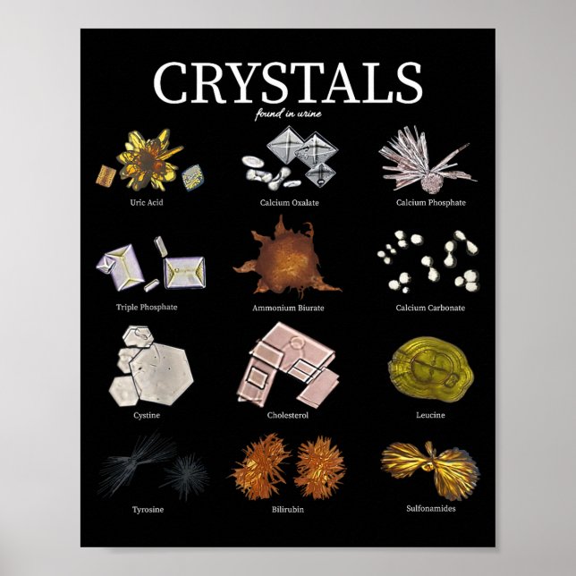 Póster Técnico de laboratorio de cristal de orina de labo (Frente)