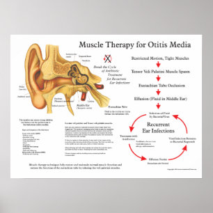 Póster Terapia de masaje muscular para Otitis Media