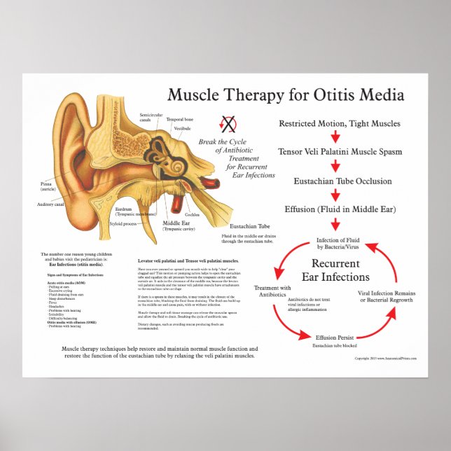 Póster Terapia de masaje muscular para Otitis Media (Frente)