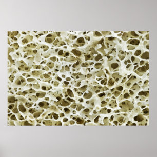 Póster Textura porosa magnificada del hueso de la cadera 