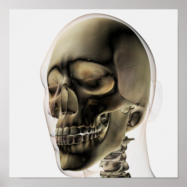 Póster Tres Vistas Dimensionales De La Calavera Y Los Die (Frente)