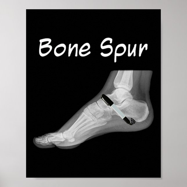 Póster Trump Bone Spur Ink Pen Funny Anti Trump  (Frente)