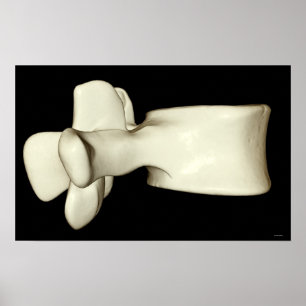 Póster Vertebra lumbar 4
