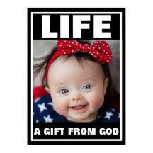 VIDA DEL NIÑO DE SÍNDROME DE SONRISA PROLIFE CUTE