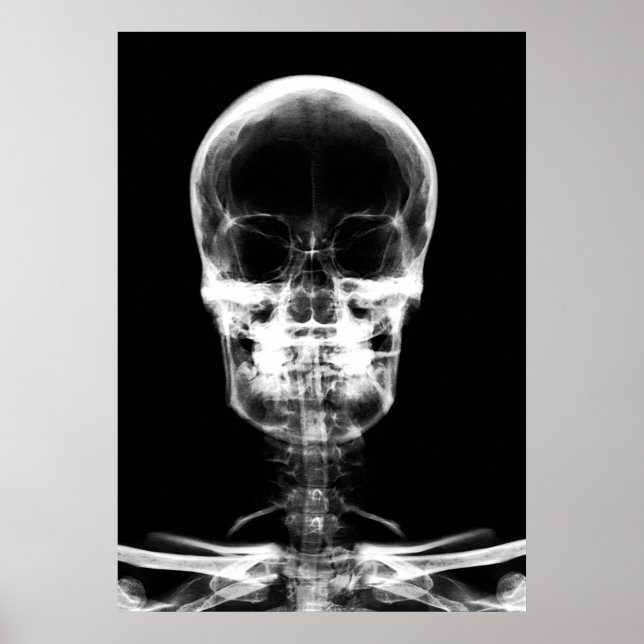 PÓSTER VISIÓN DE RAYOS X SKELETON SKULL - B&W (Frente)