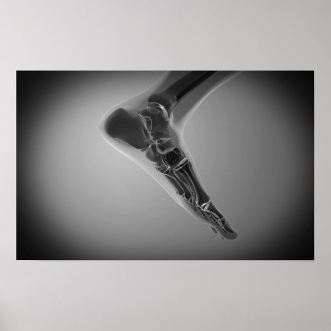 Póster Vista De Rayos X De Pie Humano 4 (Frente)