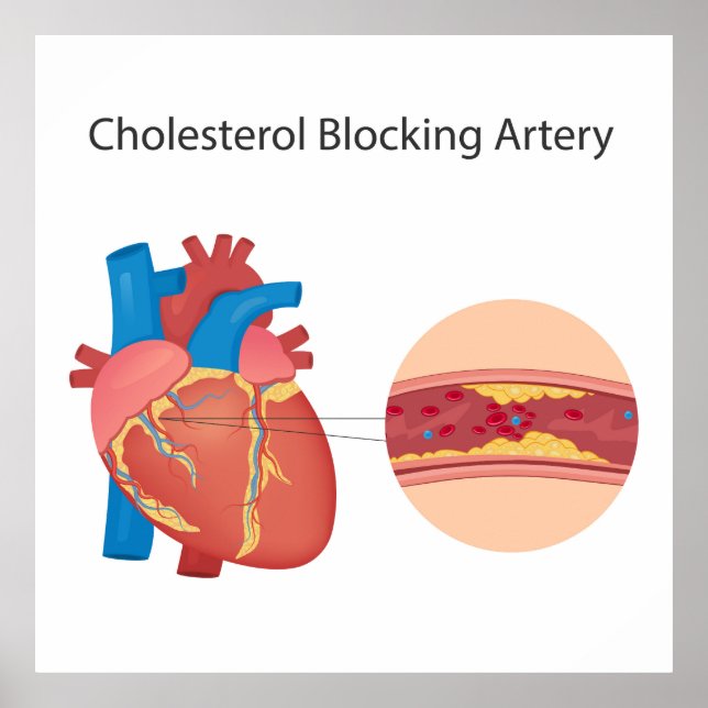 Póster Vómitos sanguíneos estrechos (Frente)