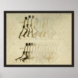 Póster Walking Gait Analysis Leg Spine Chiropractic Chart