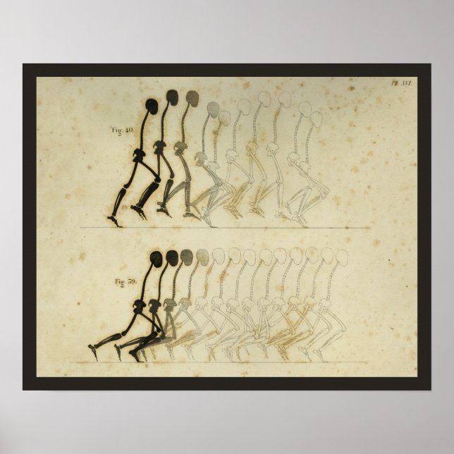 Póster Walking Gait Analysis Leg Spine Chiropractic Chart (Frente)
