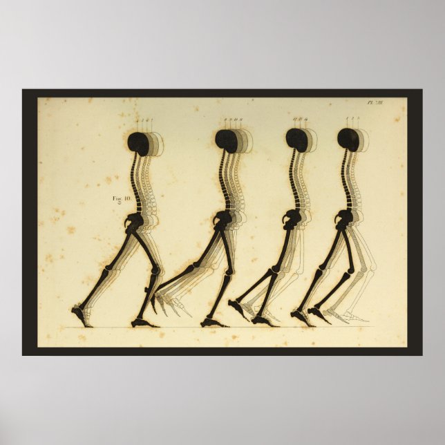 Póster Walking Gait Analysis Leg Spine Chiropractic Chart (Frente)