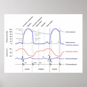 Póster Wiggers Diagrama de eventos cardiacos ventrículo i