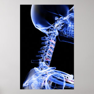 Póster X-ray image of the bones of the neck