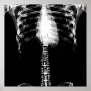 PÓSTER X-RAY SKELETON TORSO RIBS - B&W