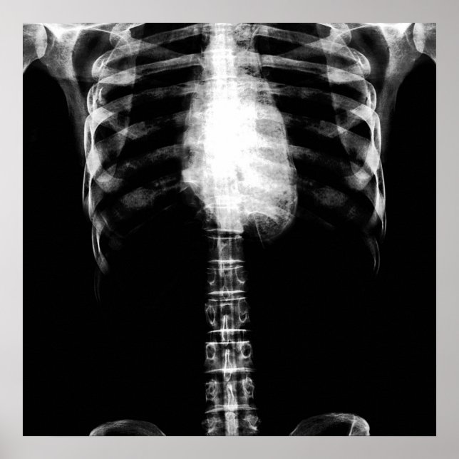 PÓSTER X-RAY SKELETON TORSO RIBS - B&W (Frente)