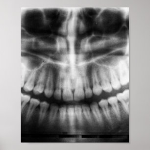 Póster X-Ray Teeth Mouth Smile Black and White