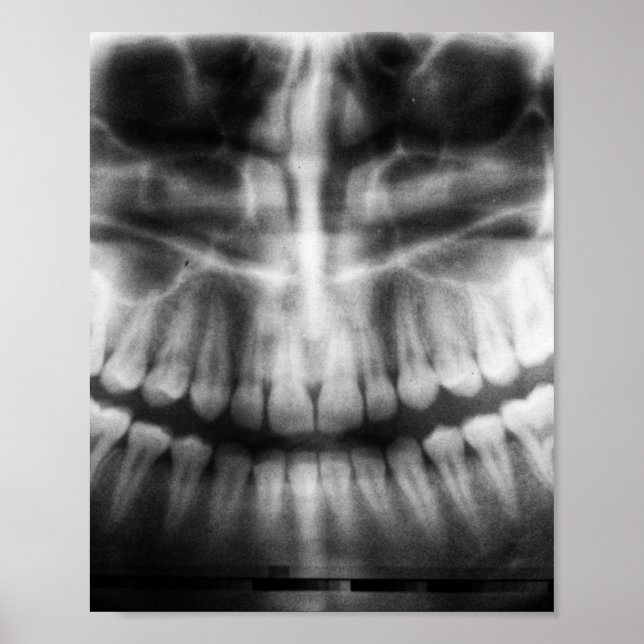 Póster X-Ray Teeth Mouth Smile Black and White (Frente)