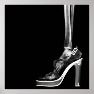 PÓSTER XRAY ALTO HEEL LADY SKELETON FOOT B&W