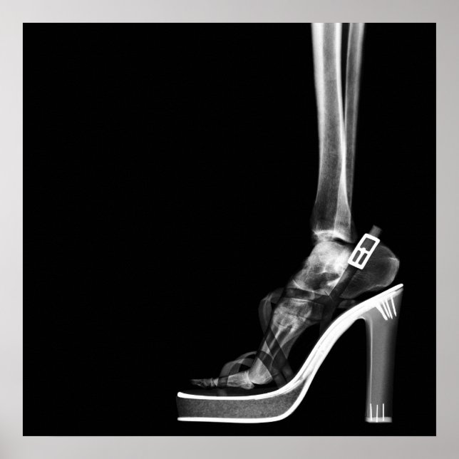 PÓSTER XRAY ALTO HEEL LADY SKELETON FOOT B&W (Frente)