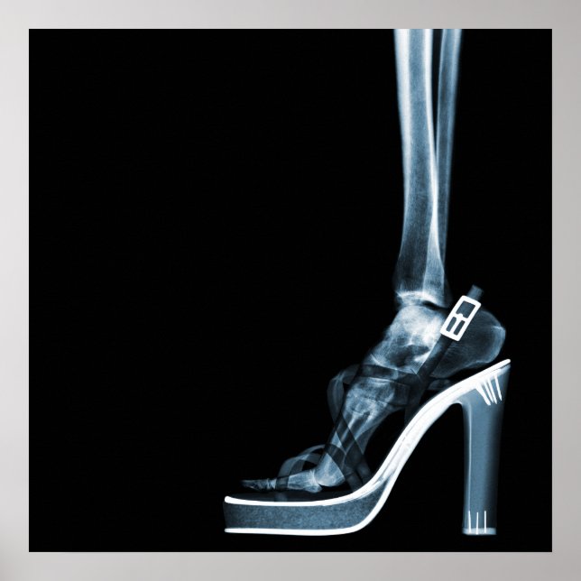 PÓSTER XRAY ALTO HEEL LADY SKELETON POOT BLUE (Frente)