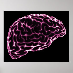 PÓSTER XRAY BRAIN SIDE VIEW PINK