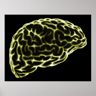 PÓSTER XRAY BRAIN SIDE VIEW YELLOW