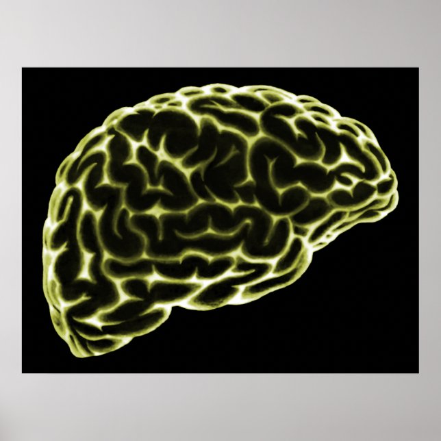 PÓSTER XRAY BRAIN SIDE VIEW YELLOW (Frente)