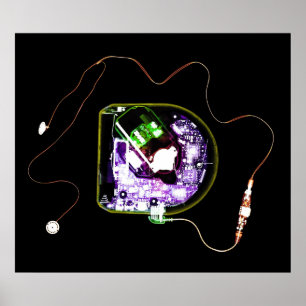 PÓSTER XRAY DISCMAN