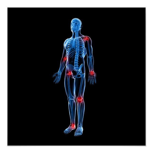 Póster Xris humano (Anverso)