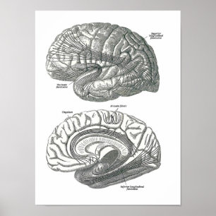 Póster Zonas de la materia blanca del cerebro