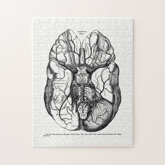 Puzzle Arterias de arte de la anatomía ventilado del cere (Vertical)