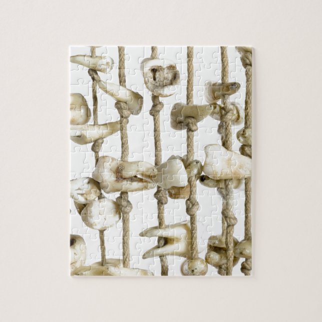 Puzzle Dentista extraído fotografía dental divertida de (Vertical)